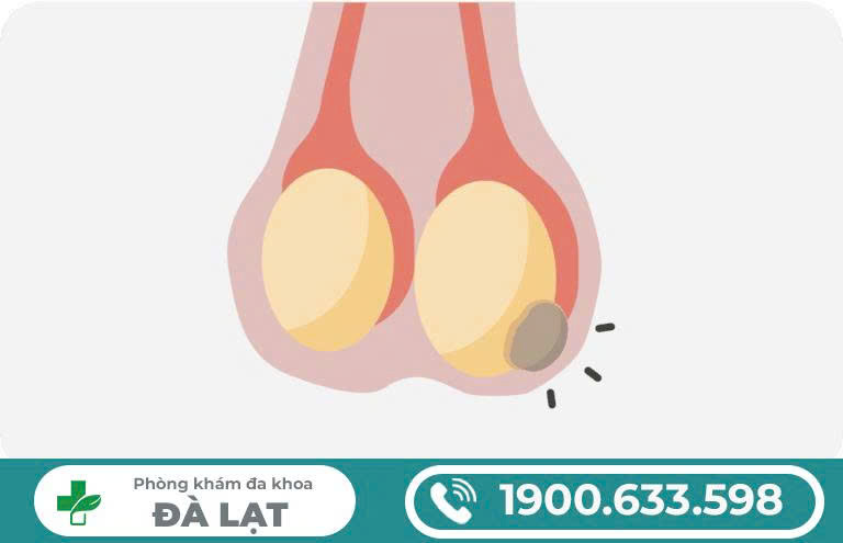 Hình ảnh minh họa